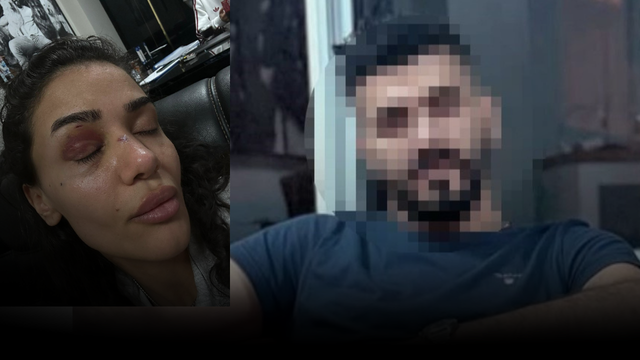 Eski sevgilisinin darbettiği Ebru'nun yardım çığlığı! Ölmeden önce sesimi duyun