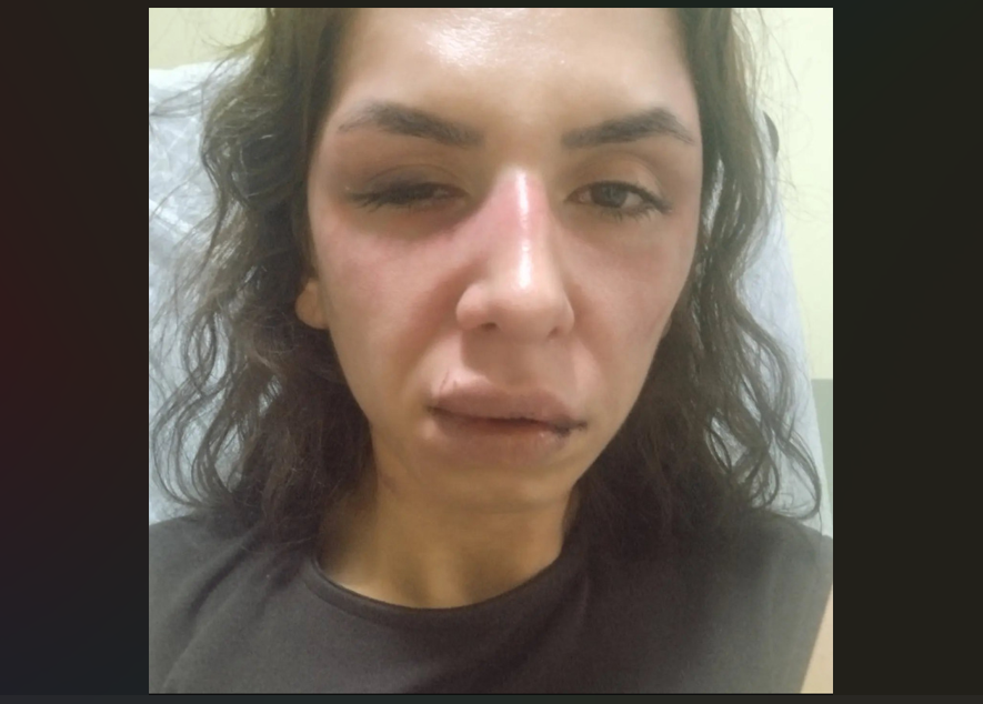 Eşini darbeden şüpheli tutuklandı