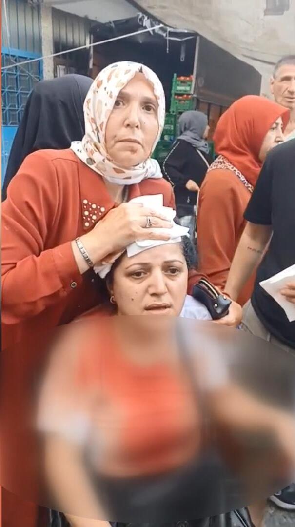 Pazarcı dehşeti! Kadın müşteriye kalasla saldırdı başına 10 dikiş atıldı!